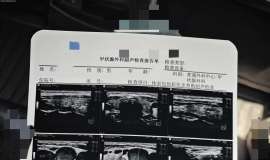 癌我别怕-记录治疗过程