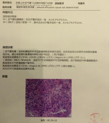 病理报告