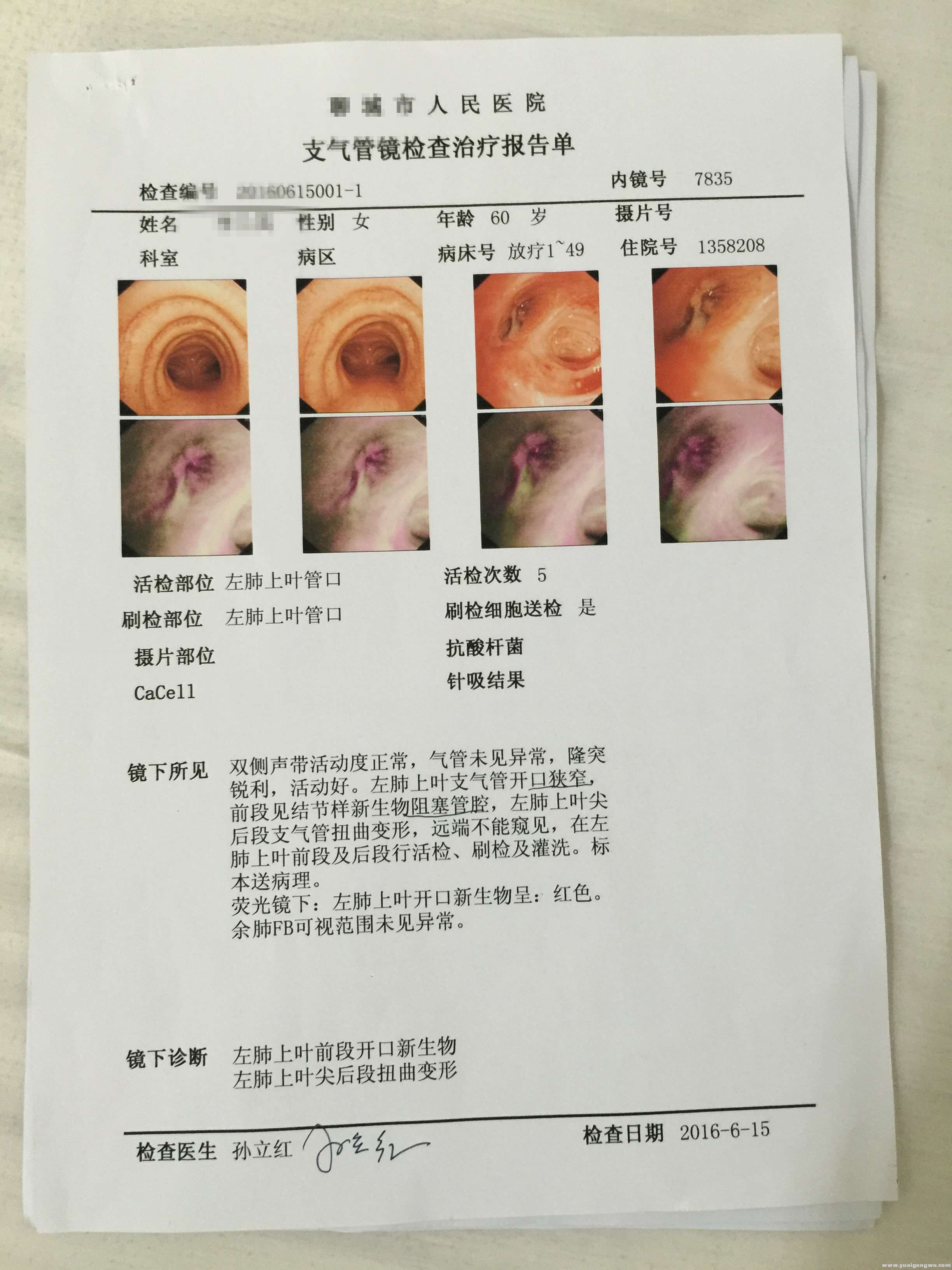 支气管镜