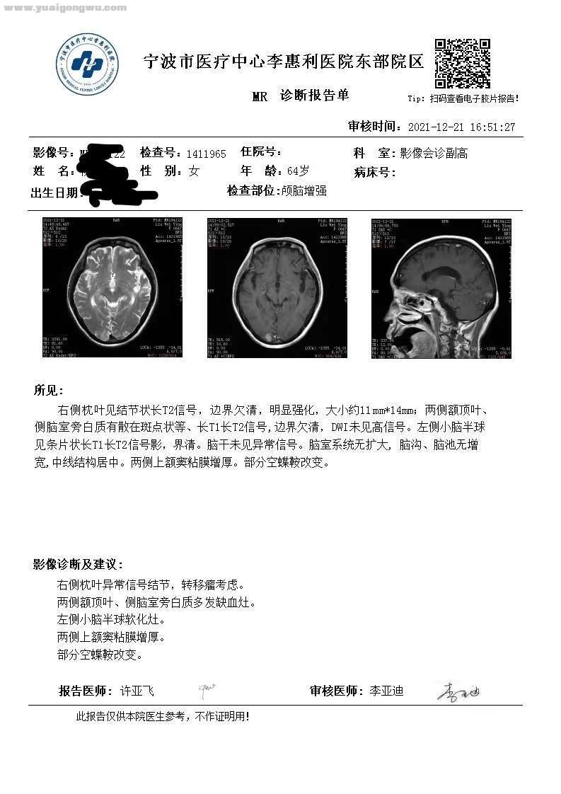 脑部2021.12