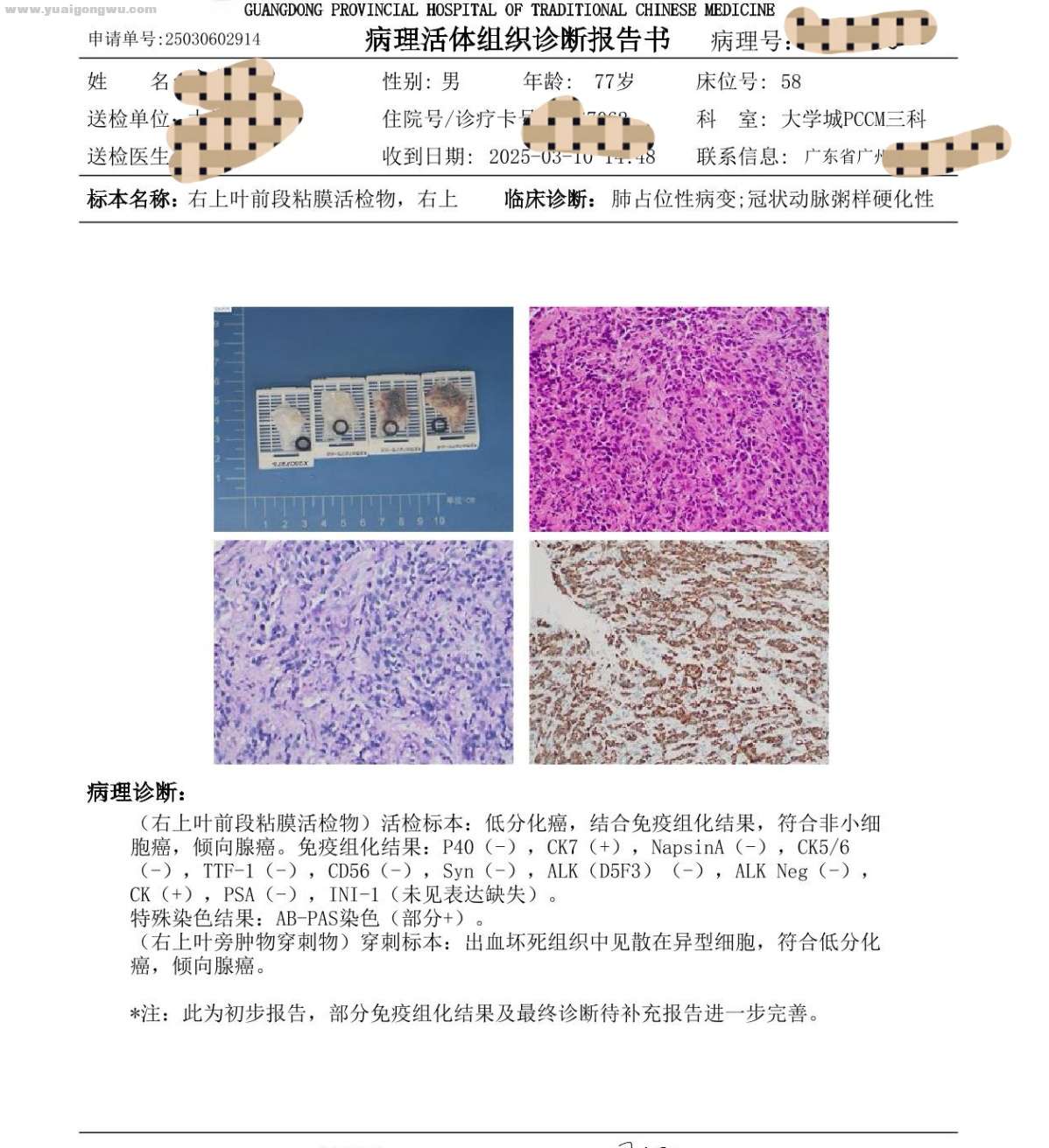 病理检测报告